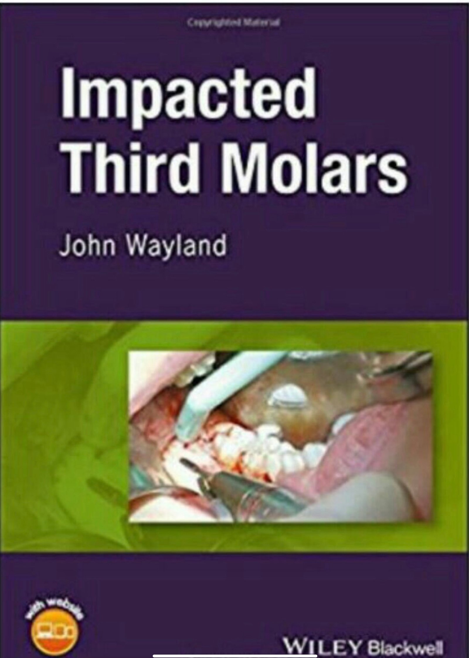 Impacted Third Molars