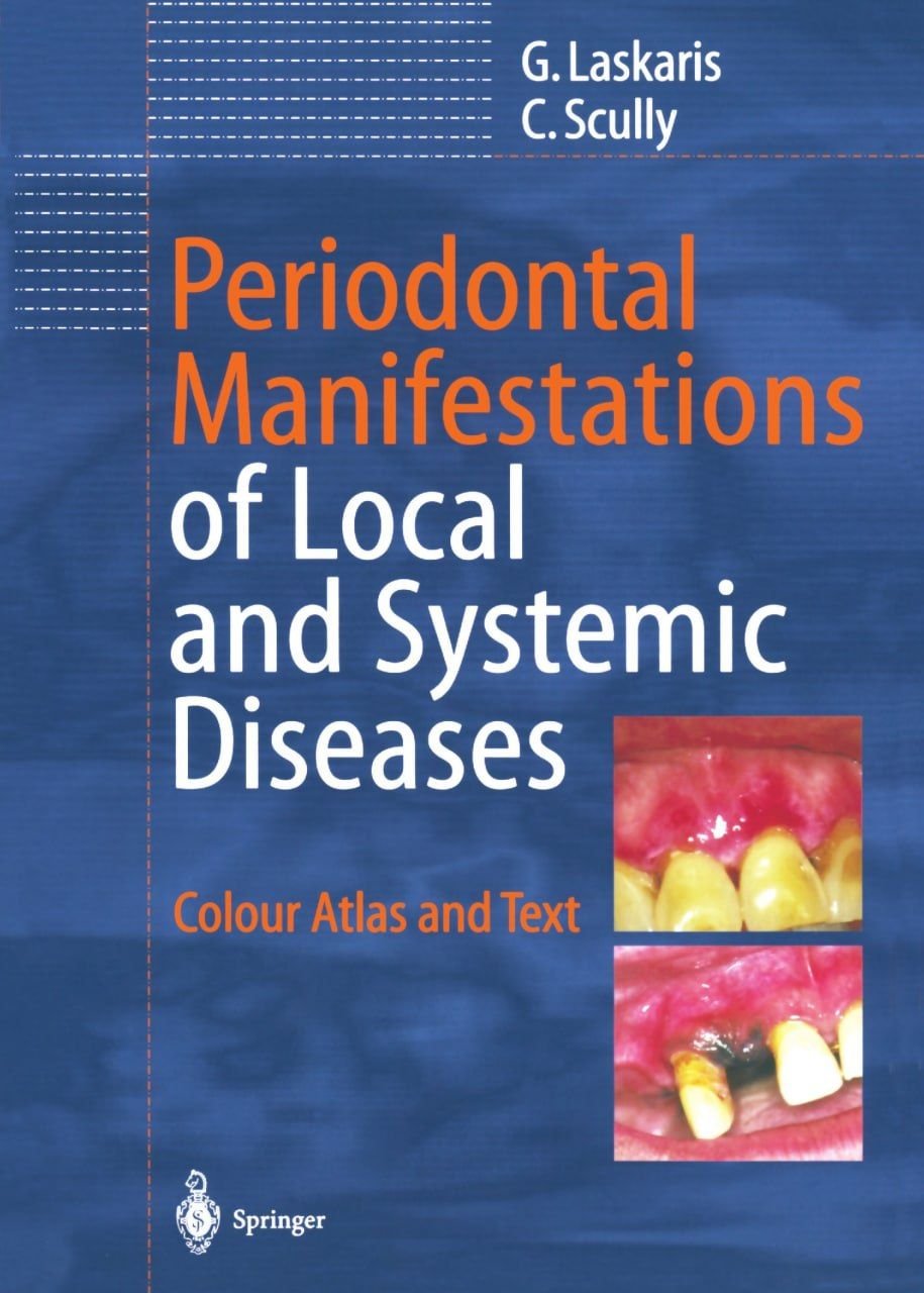 Periodontal-Manifestations-of-Local-and-Systemic-Diseases